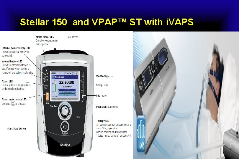Stellar 150 and VPAP™ ST with i. VAPS 