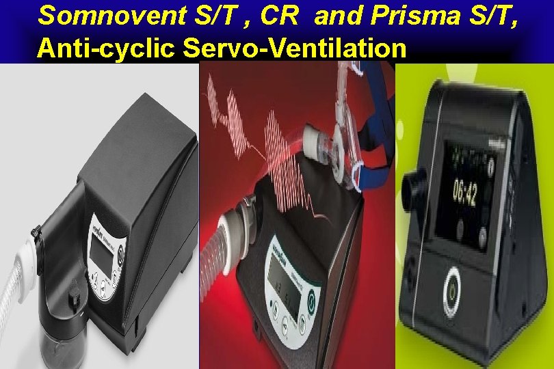 Somnovent S/T , CR and Prisma S/T, Anti-cyclic Servo-Ventilation 