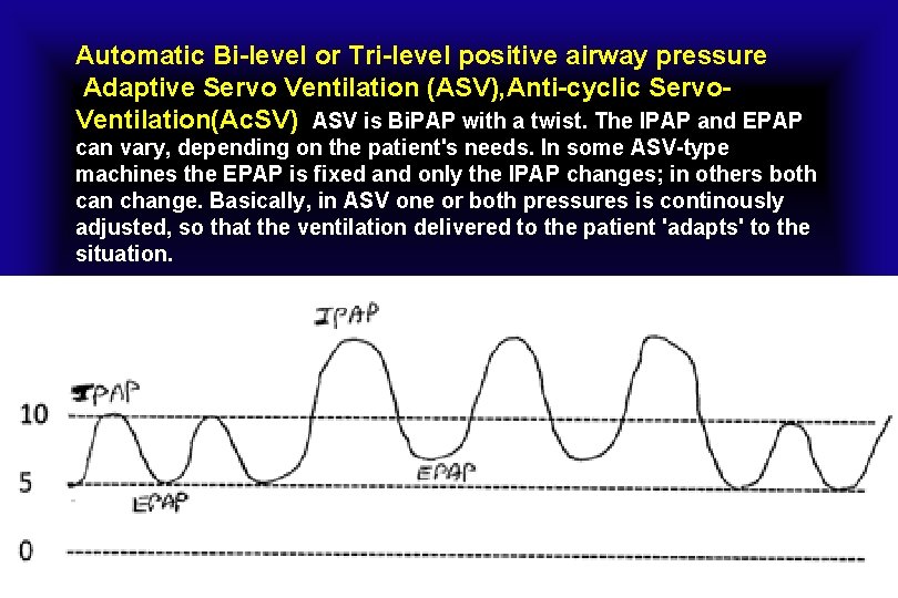Automatic Bi-level or Tri-level positive airway pressure Adaptive Servo Ventilation (ASV), Anti-cyclic Servo. Ventilation(Ac.