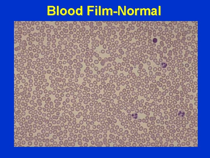 Blood Film-Normal 