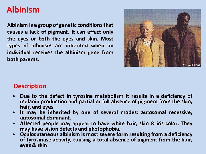 Albinism is a group of genetic conditions that causes a lack of pigment. It