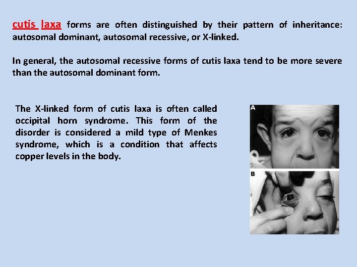 cutis laxa forms are often distinguished by their pattern of inheritance: autosomal dominant, autosomal