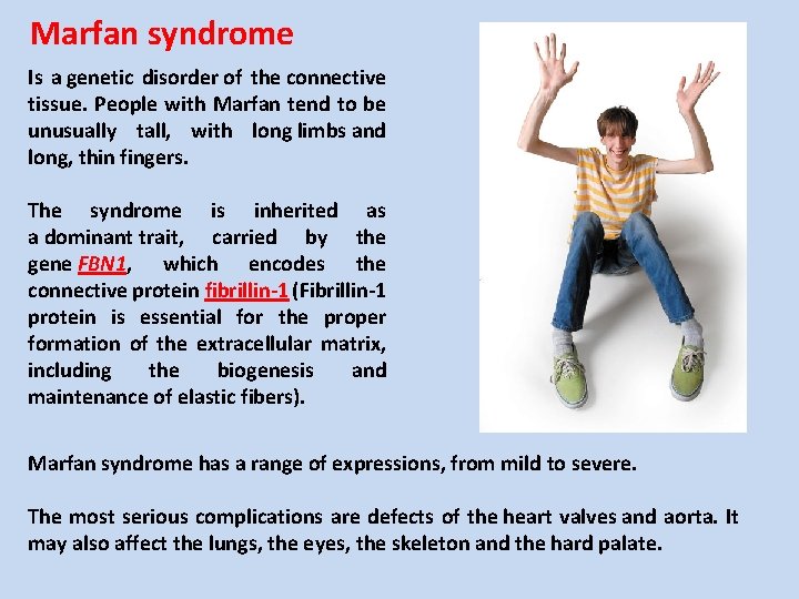 Marfan syndrome Is a genetic disorder of the connective tissue. People with Marfan tend