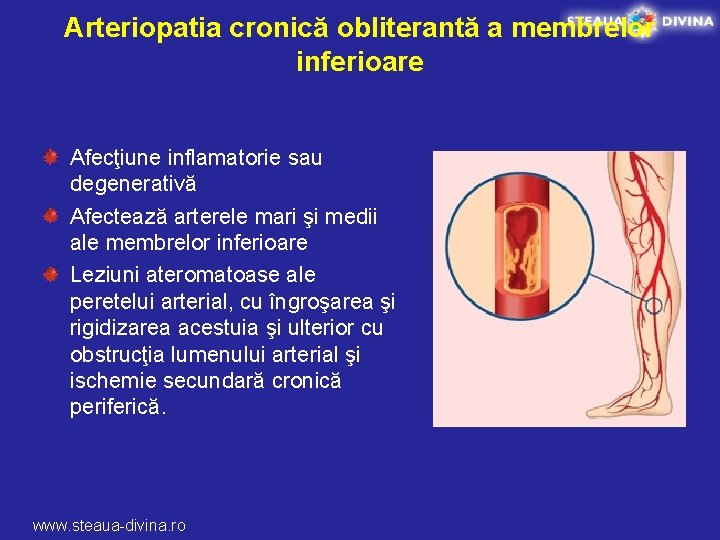 Arteriopatia cronică obliterantă a membrelor inferioare Afecţiune inflamatorie sau degenerativă Afectează arterele mari şi