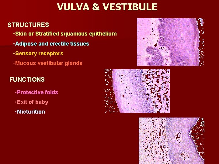 VULVA & VESTIBULE STRUCTURES • Skin or Stratified squamous epithelium • Adipose and erectile