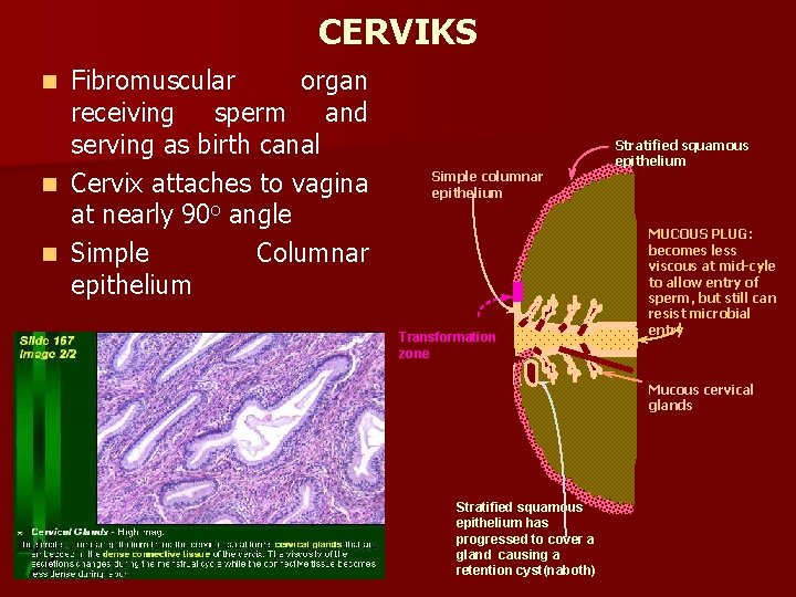 CERVIKS Fibromuscular organ receiving sperm and serving as birth canal n Cervix attaches to