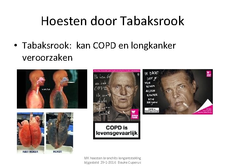Hoesten Bronchitis en Pneunomie MK hoesten bronchits longontsteking