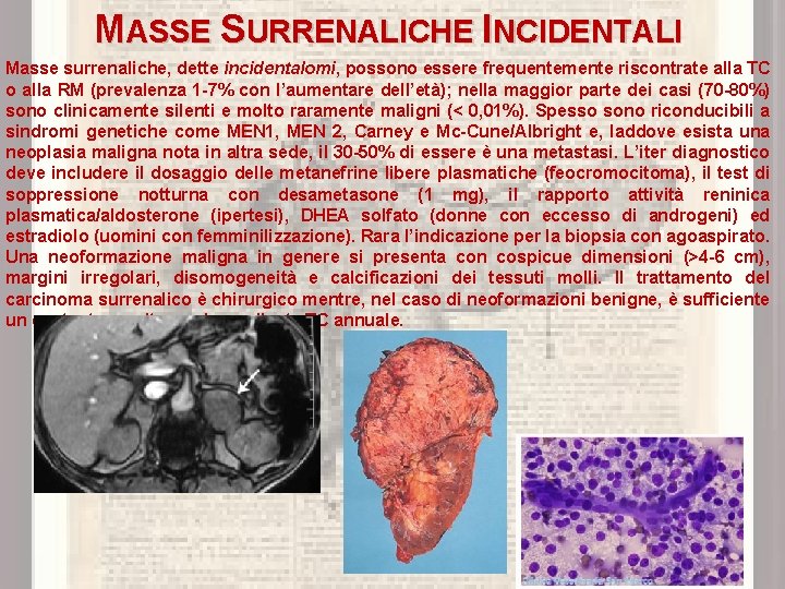 MASSE SURRENALICHE INCIDENTALI Masse surrenaliche, dette incidentalomi, possono essere frequentemente riscontrate alla TC o