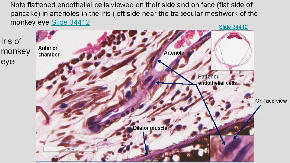 Note flattened endothelial cells viewed on their side and on face (flat side of