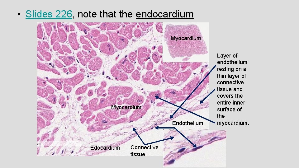  • Slides 226, note that the endocardium Myocardium Endothelium Edocardium Connective tissue Layer