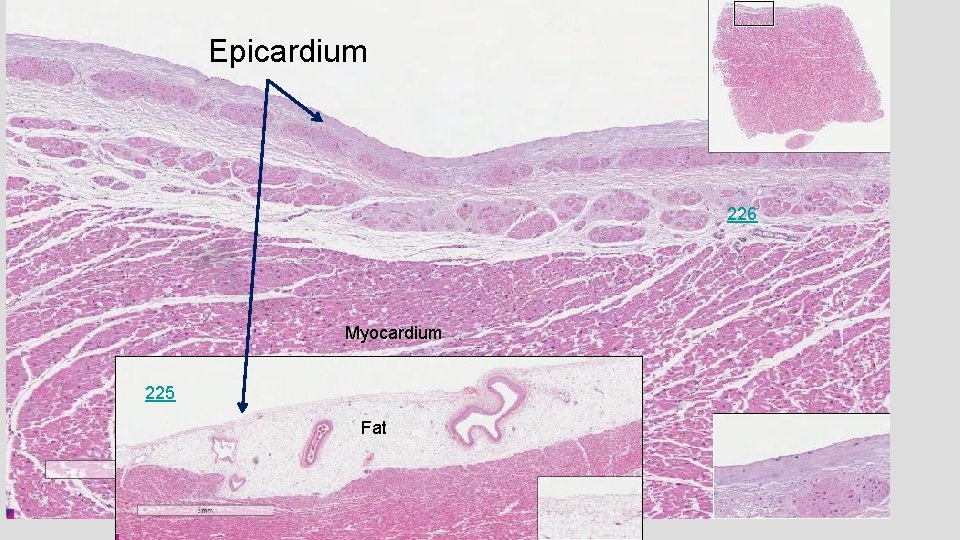 Epicardium 226 Myocardium 225 Fat 