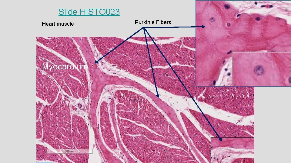 Slide HISTO 023 Heart muscle Myocardium Purkinje Fibers 