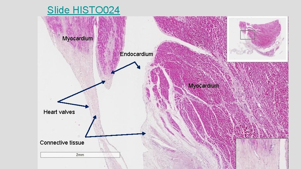 Slide HISTO 024 Myocardium Endocardium Myocardium Heart valves Connective tissue 