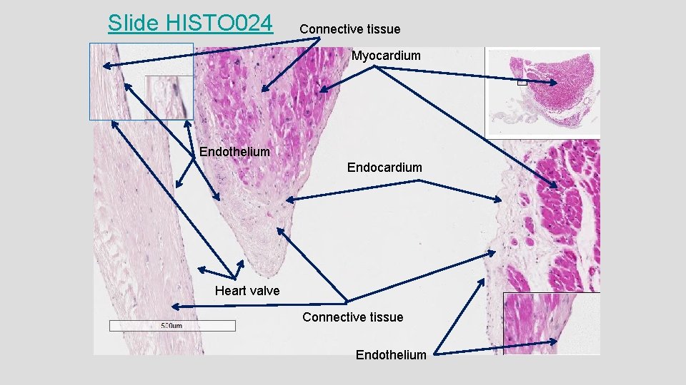 Slide HISTO 024 Connective tissue Myocardium Endothelium Endocardium Heart valve Connective tissue Endothelium 