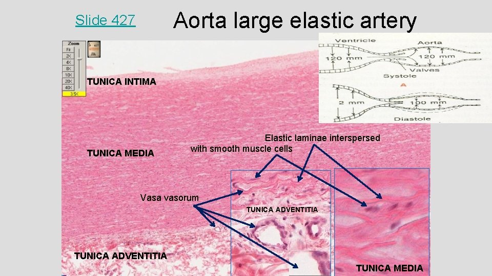 Aorta large elastic artery Slide 427 TUNICA ADVENTITIA TUNICA INTIMA TUNICA MEDIA Elastic laminae