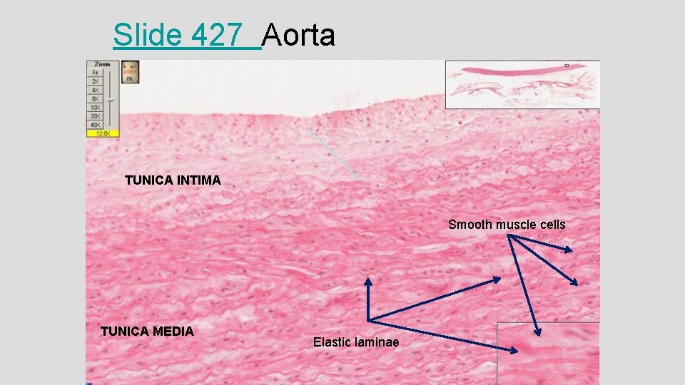Slide 427 Aorta TUNICA INTIMA Smooth muscle cells TUNICA MEDIA Elastic laminae 