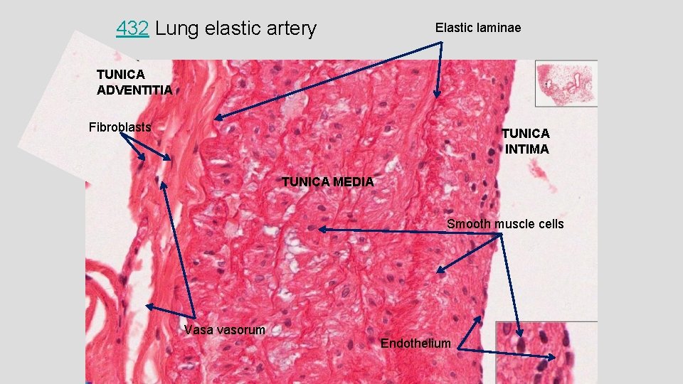 432 Lung elastic artery Elastic laminae TUNICA ADVENTITIA Fibroblasts TUNICA INTIMA TUNICA MEDIA Smooth