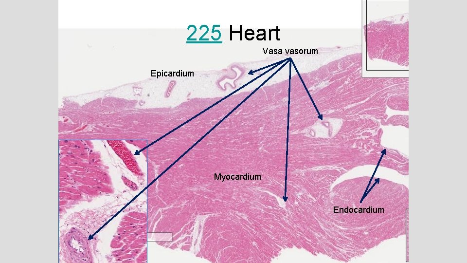 225 Heart Vasa vasorum Epicardium Myocardium Endocardium 