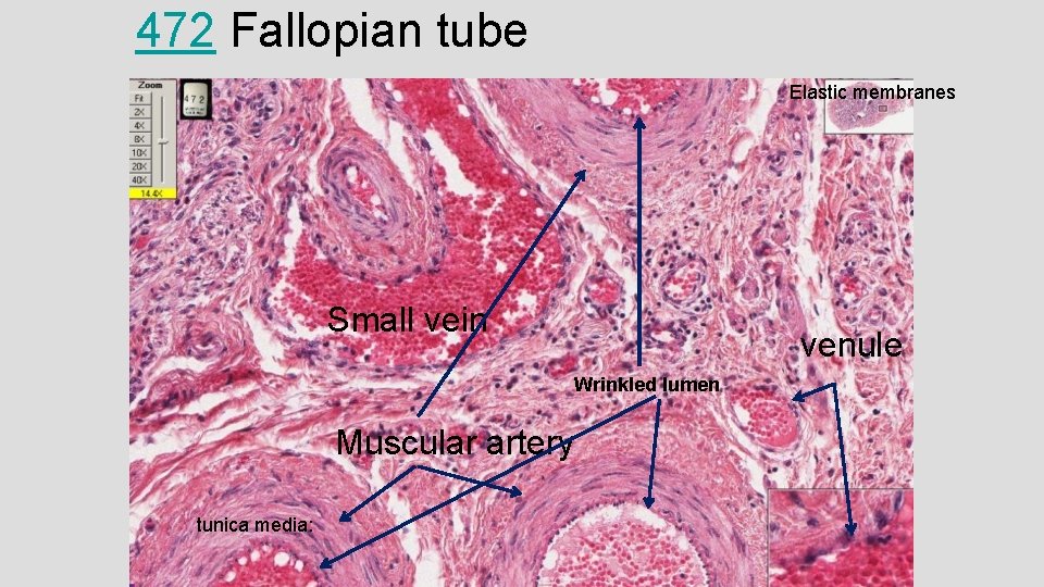472 Fallopian tube Elastic membranes Small vein venule Wrinkled lumen Muscular artery tunica media: