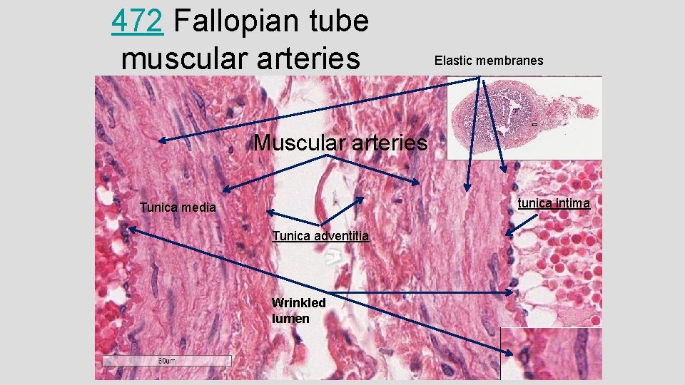 472 Fallopian tube muscular arteries Elastic membranes Muscular arteries tunica intima Tunica media Tunica