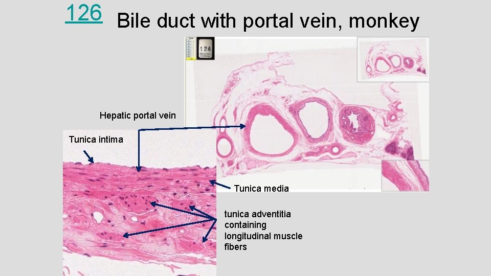 126 Bile duct with portal vein, monkey Hepatic portal vein Tunica intima Tunica media