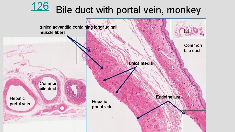 126 Bile duct with portal vein, monkey tunica adventitia containing longitudinal muscle fibers Common