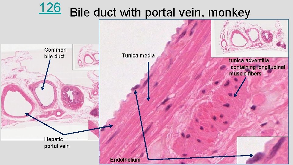 126 Bile duct with portal vein, monkey Common bile duct Tunica media Hepatic portal