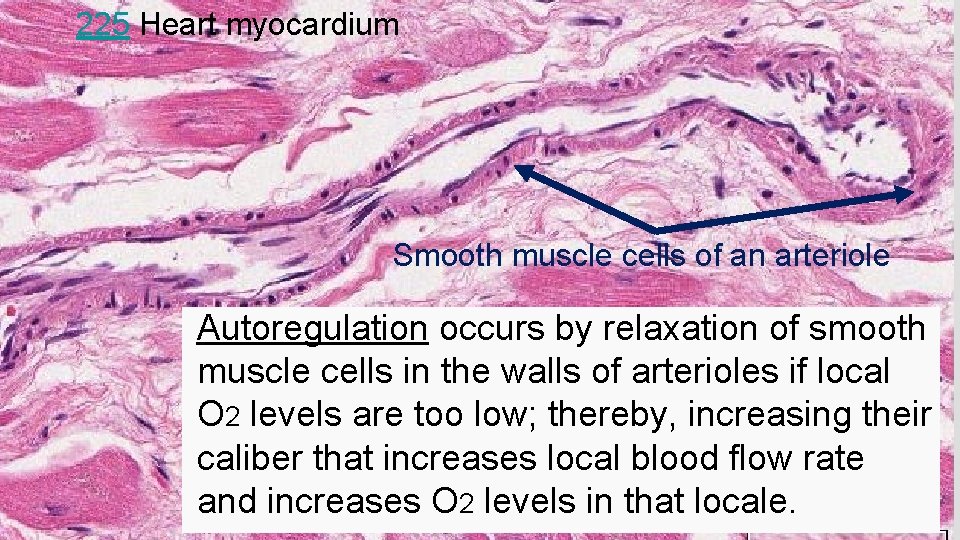 225 Heart myocardium Smooth muscle cells of an arteriole Autoregulation occurs by relaxation of