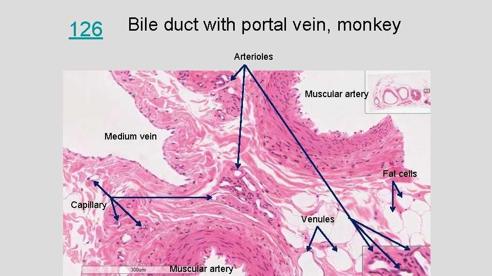 Bile duct with portal vein, monkey 126 Arterioles Muscular artery Medium vein Fat cells