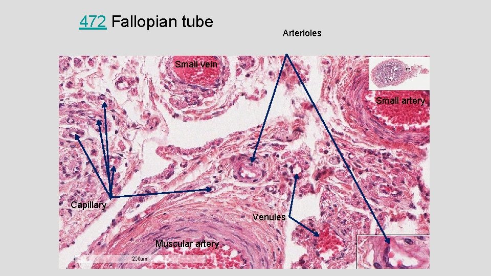 472 Fallopian tube Arterioles Small vein Small artery Capillary Venules Muscular artery 