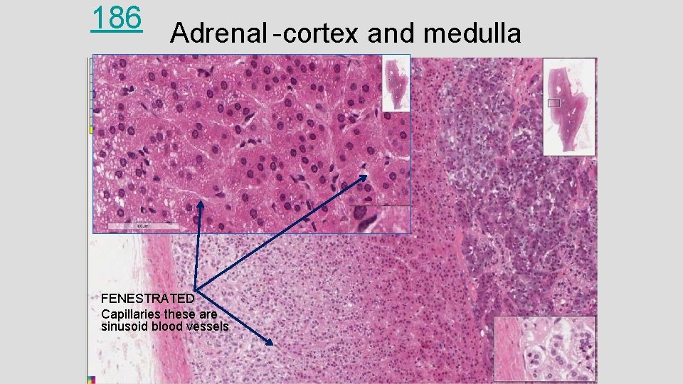 186 Adrenal -cortex and medulla FENESTRATED Capillaries these are sinusoid blood vessels 