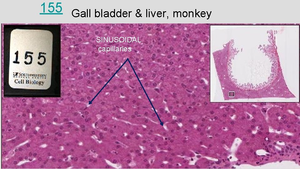 155 Gall bladder & liver, monkey SINUSOIDAL capillaries 