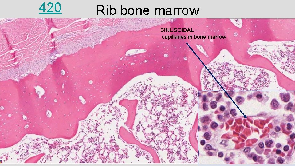 420 Rib bone marrow SINUSOIDAL capillaries in bone marrow 