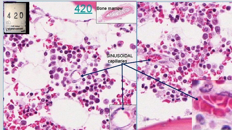 420 Bone marrow SINUSOIDAL capillaries 