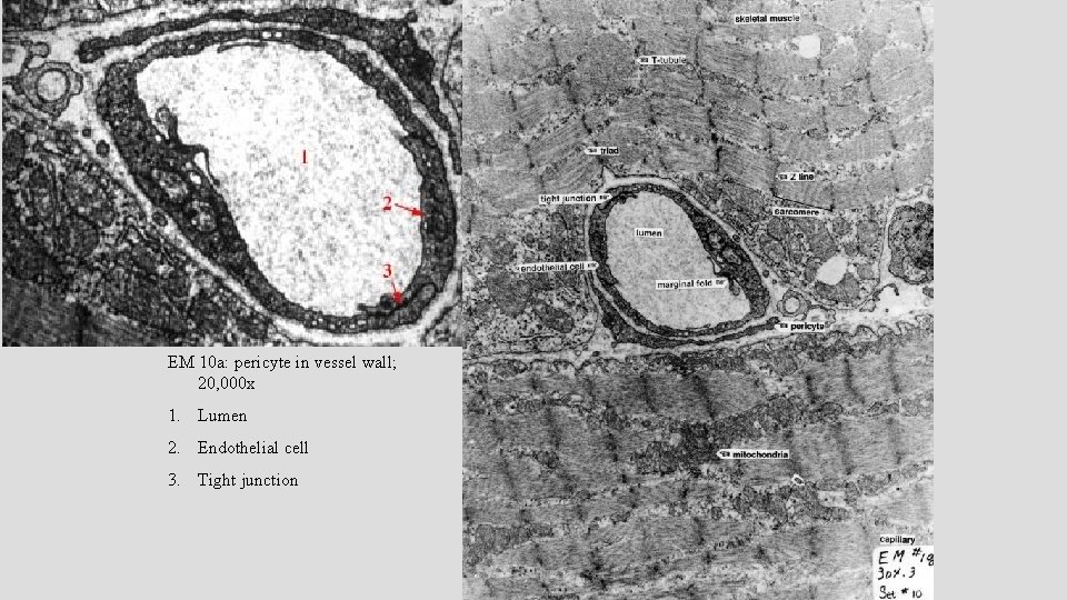 EM 10 a: pericyte in vessel wall; 20, 000 x 1. Lumen 2. Endothelial