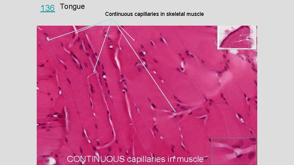 136 Tongue Continuous capillaries in skeletal muscle CONTINUOUS capillaries in muscle 