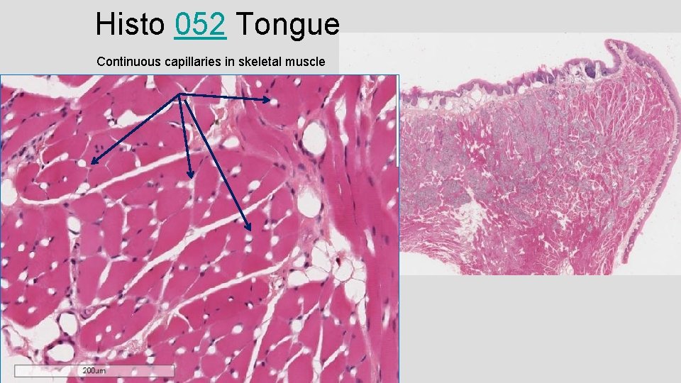 Histo 052 Tongue Continuous capillaries in skeletal muscle 