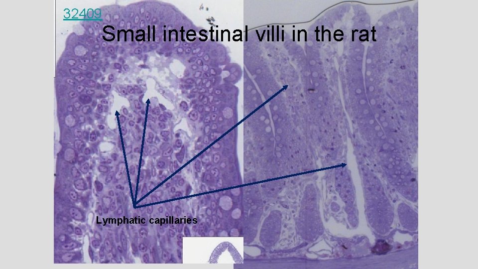 32409 Small intestinal villi in the rat Lymphatic capillaries 