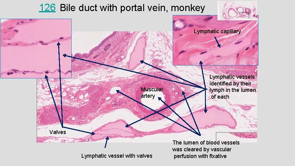 126 Bile duct with portal vein, monkey Lymphatic capillary Muscular artery Lymphatic vessels identified