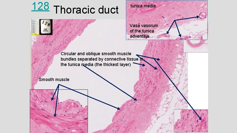 128 Thoracic duct tunica media Vasa vasorum of the tunica adventitia Circular and oblique