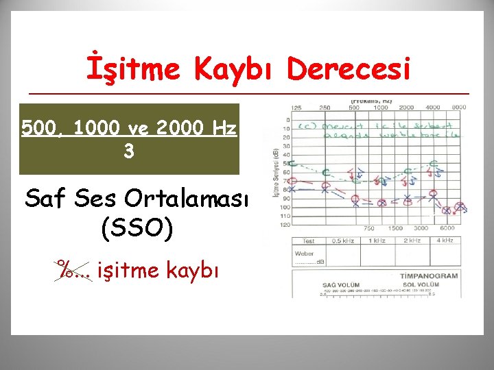 İşitme Kaybı Derecesi 500, 1000 ve 2000 Hz 3 Saf Ses Ortalaması (SSO) %.