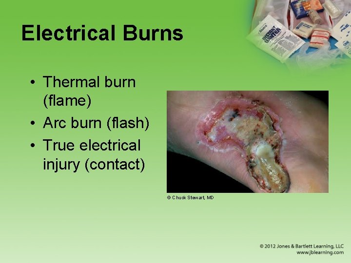 Electrical Burns • Thermal burn (flame) • Arc burn (flash) • True electrical injury