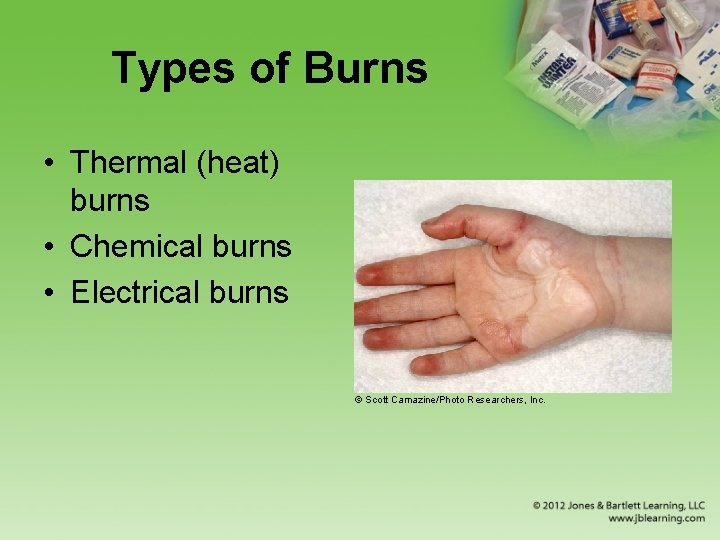 Types of Burns • Thermal (heat) burns • Chemical burns • Electrical burns ©