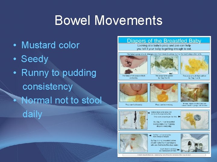 Bowel Movements • Mustard color • Seedy • Runny to pudding consistency • Normal Bowel Movements • Mustard color • Seedy • Runny to pudding consistency • Normal