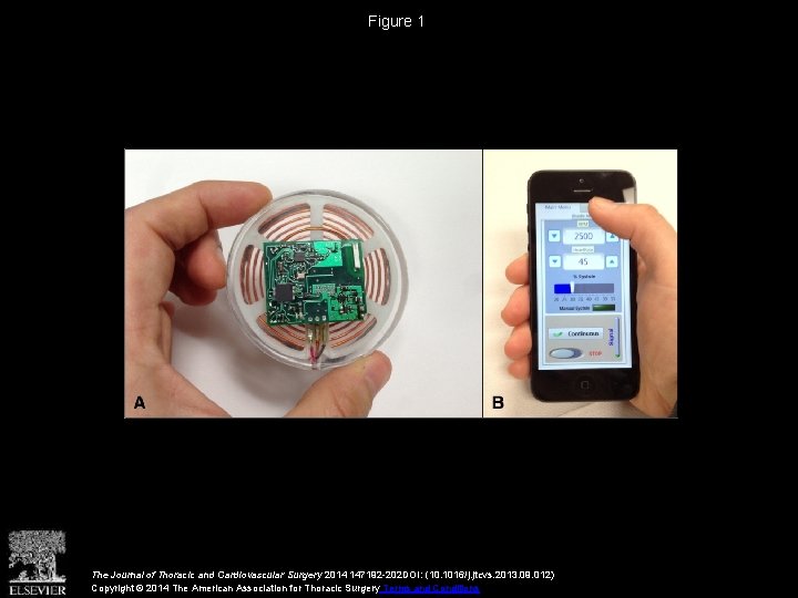 Figure 1 The Journal of Thoracic and Cardiovascular Surgery 2014 147192 -202 DOI: (10.