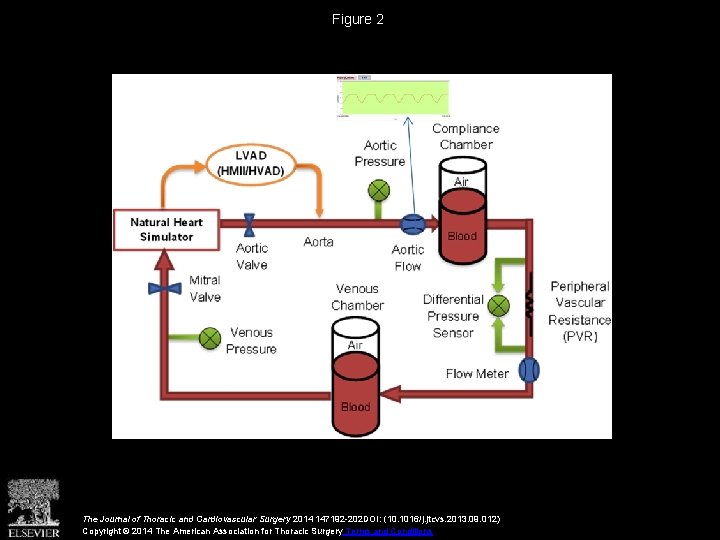 Figure 2 The Journal of Thoracic and Cardiovascular Surgery 2014 147192 -202 DOI: (10.