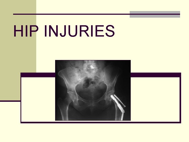 HIP INJURIES 