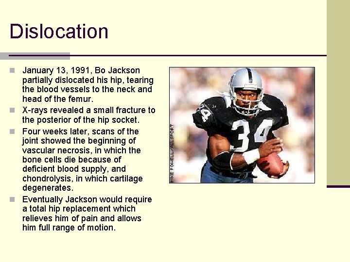 Dislocation n January 13, 1991, Bo Jackson partially dislocated his hip, tearing the blood