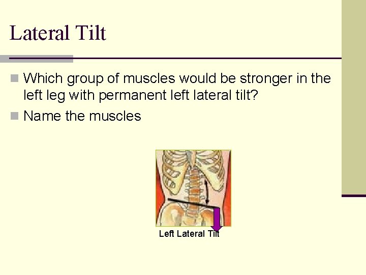 Lateral Tilt n Which group of muscles would be stronger in the left leg