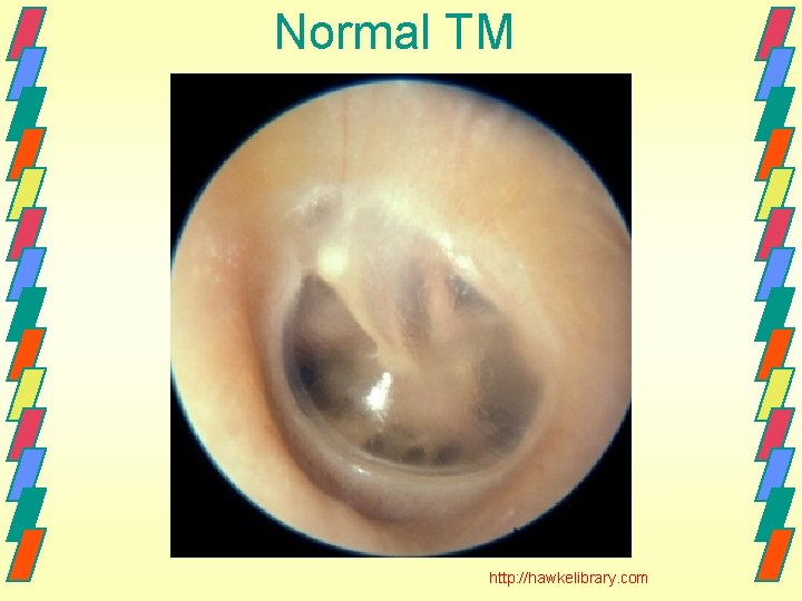 Normal TM http: //hawkelibrary. com 